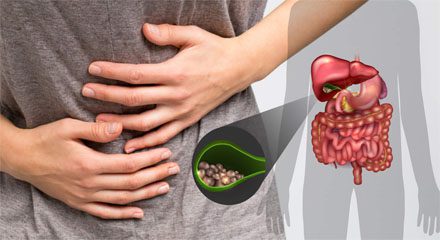 gallbladder stones treatment without operation