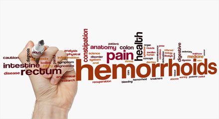 hemorrhoids home remedies1