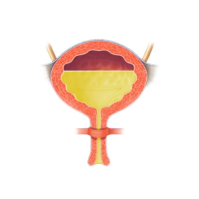 Urodynamics