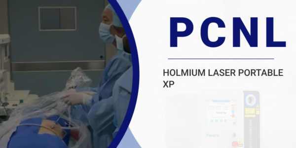 Holmium Laser for Percutaneous Nephrolithotomy PCNL