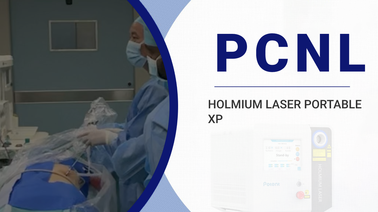 Holmium Laser for Percutaneous Nephrolithotomy PCNL