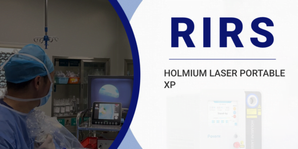 Ureteroscopy With Holmium Laser Lithotripsy