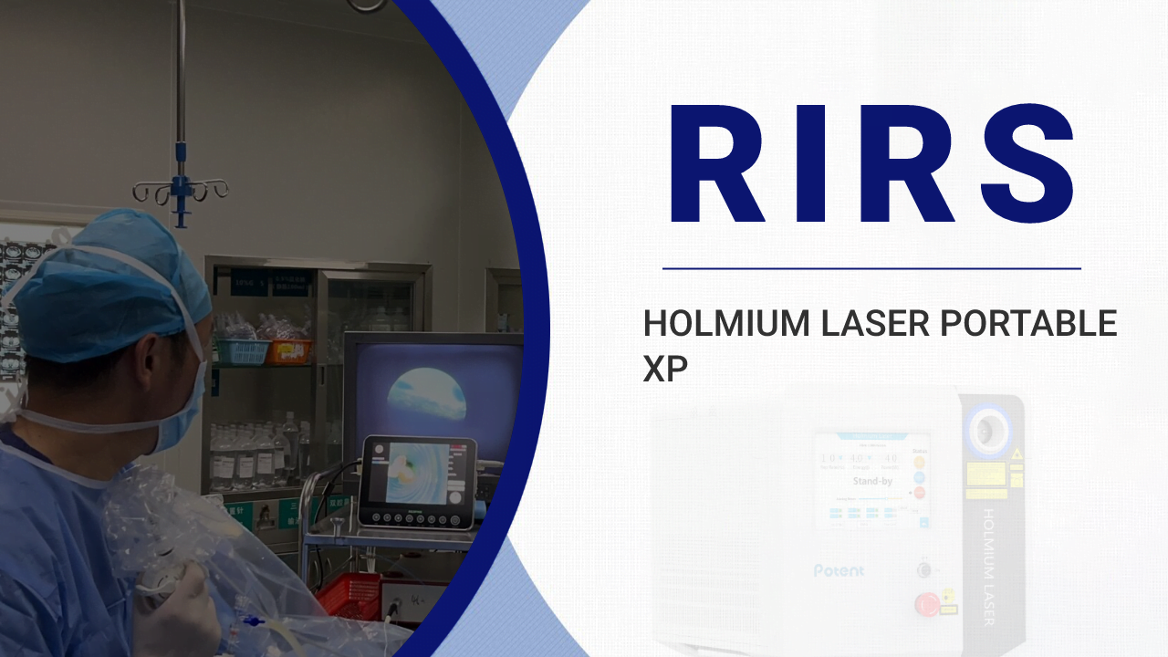 Ureteroscopy With Holmium Laser Lithotripsy Potent Medical